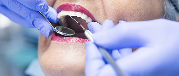 Best Broken or Chipped Tooth Repair in The Pinery, CO